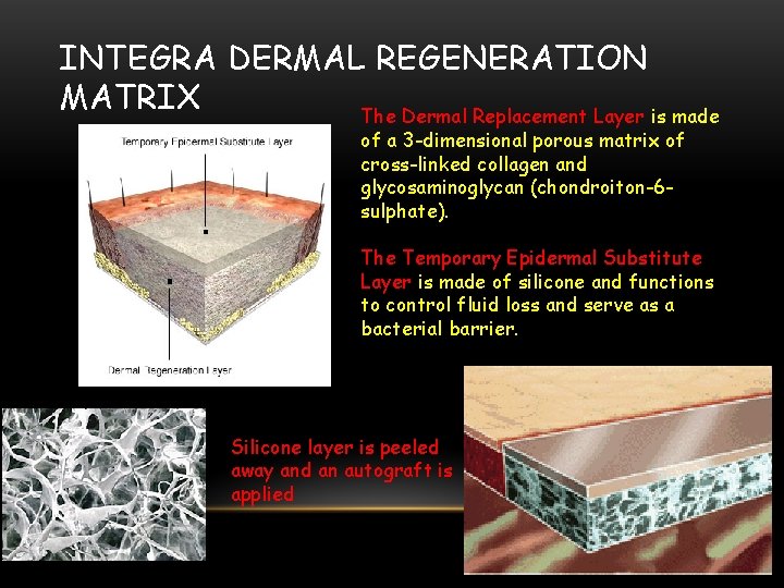 INTEGRA DERMAL REGENERATION MATRIX The Dermal Replacement Layer is made of a 3 -dimensional