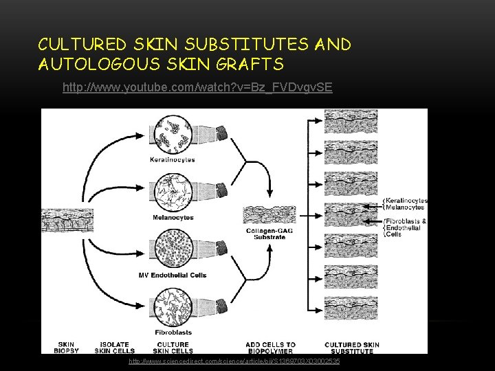 CULTURED SKIN SUBSTITUTES AND AUTOLOGOUS SKIN GRAFTS http: //www. youtube. com/watch? v=Bz_FVDvgv. SE http: