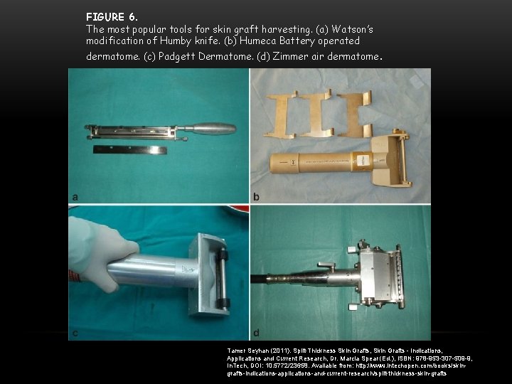 FIGURE 6. The most popular tools for skin graft harvesting. (a) Watson’s modification of