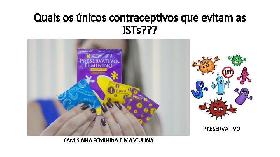 Quais os únicos contraceptivos que evitam as ISTs? ? ? PRESERVATIVO CAMISINHA FEMININA E