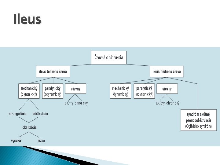 Ileus 