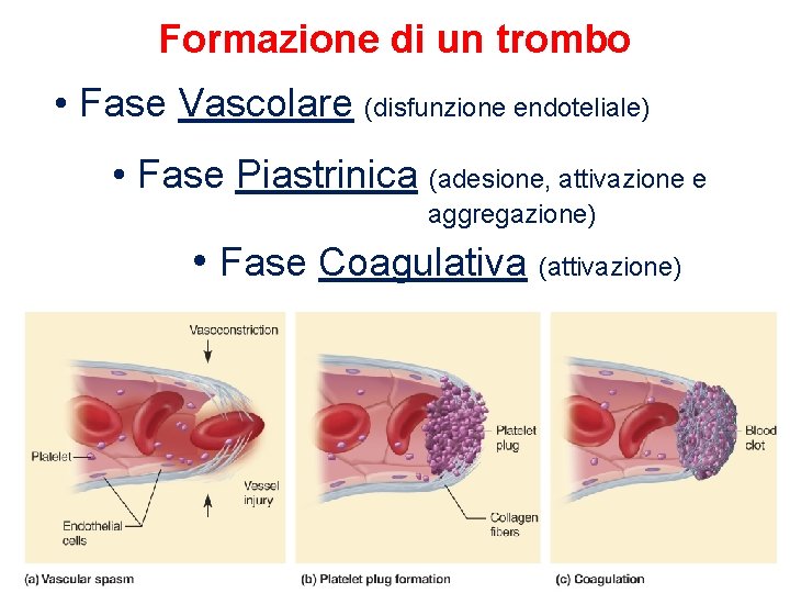 Formazione di un trombo • Fase Vascolare (disfunzione endoteliale) • Fase Piastrinica (adesione, attivazione