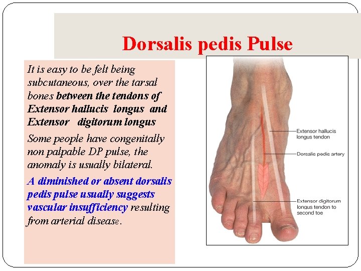 Dorsalis pedis Pulse It is easy to be felt being subcutaneous, over the tarsal