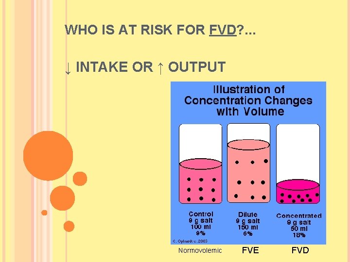 WHO IS AT RISK FOR FVD? . . . ↓ INTAKE OR ↑ OUTPUT WHO IS AT RISK FOR FVD? . . . ↓ INTAKE OR ↑ OUTPUT