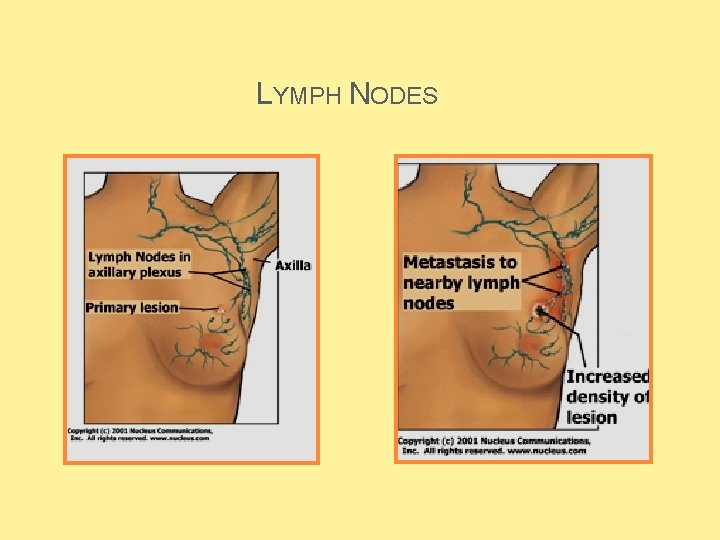 LYMPH NODES  LYMPH NODES