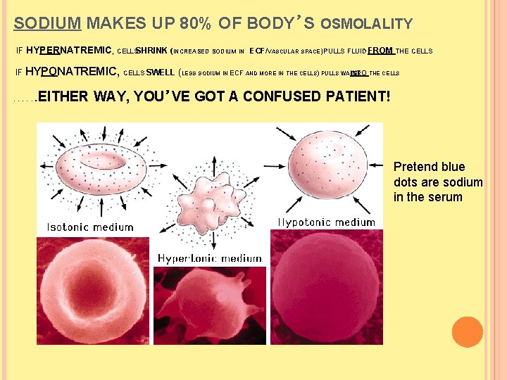 SODIUM MAKES UP 80% OF BODY’S OSMOLALITY IF HYPERNATREMIC, CELLSSHRINK (INCREASED SODIUM IN ECF/VASCULAR SODIUM MAKES UP 80% OF BODY’S OSMOLALITY IF HYPERNATREMIC, CELLSSHRINK (INCREASED SODIUM IN ECF/VASCULAR
