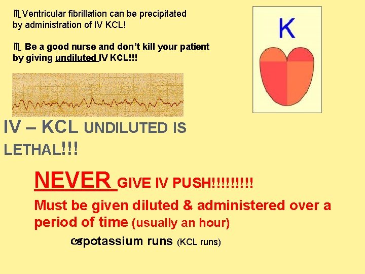 Ventricular fibrillation can be precipitated by administration of IV KCL! Be a good  Ventricular fibrillation can be precipitated by administration of IV KCL! Be a good