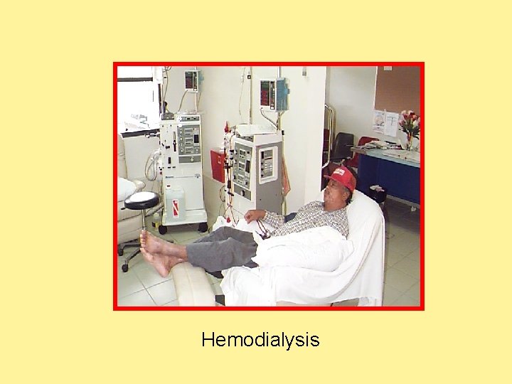 Hemodialysis  Hemodialysis