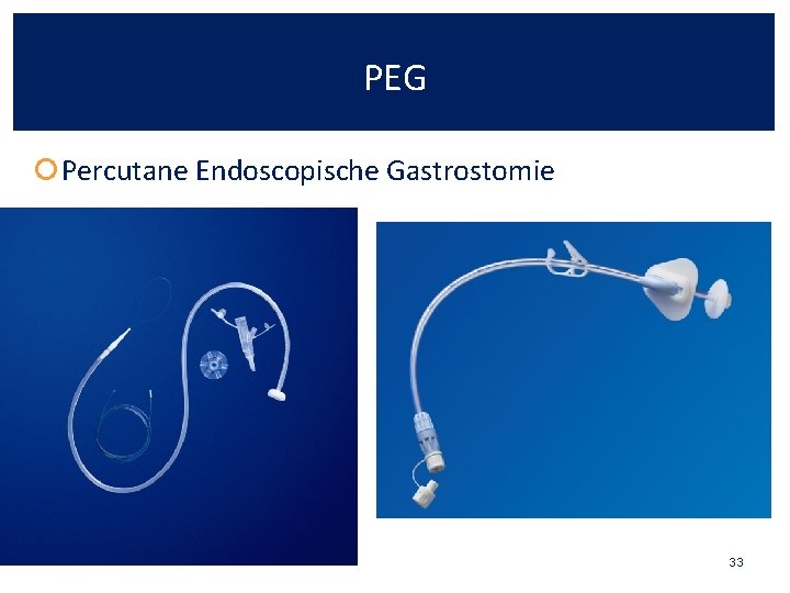 PEG Percutane Endoscopische Gastrostomie 33 