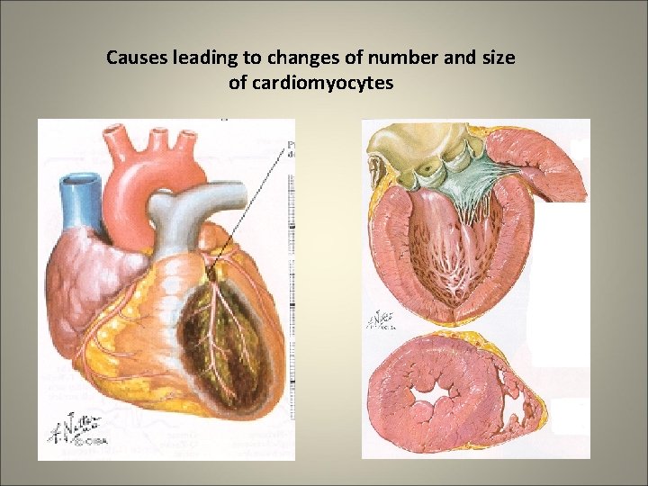 Causes leading to changes of number and size of cardiomyocytes 