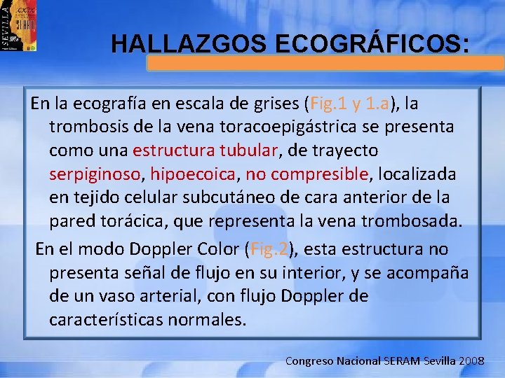 HALLAZGOS ECOGRÁFICOS: En la ecografía en escala de grises (Fig. 1 y 1. a),