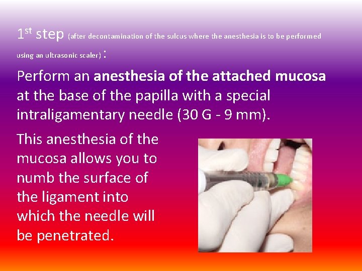 1 st step (after decontamination of the sulcus where the anesthesia is to be