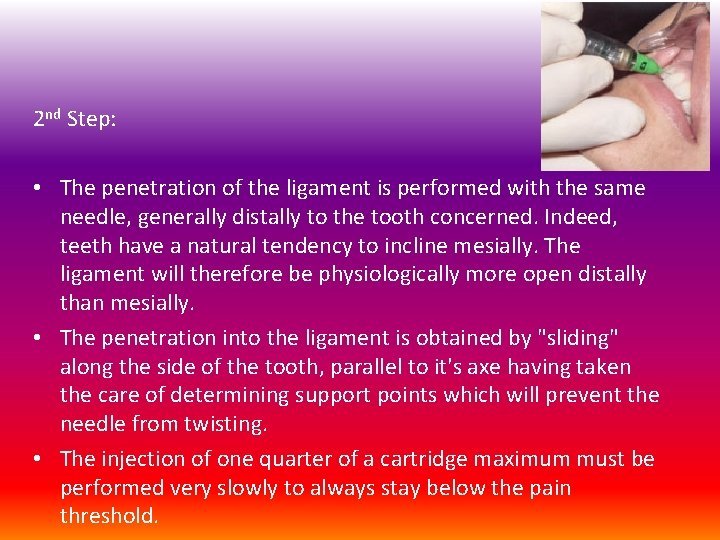 2 nd Step: • The penetration of the ligament is performed with the same