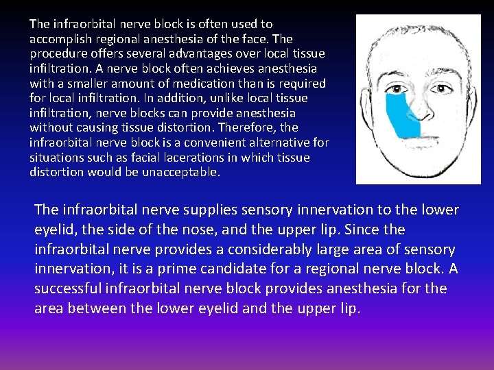 The infraorbital nerve block is often used to accomplish regional anesthesia of the face.