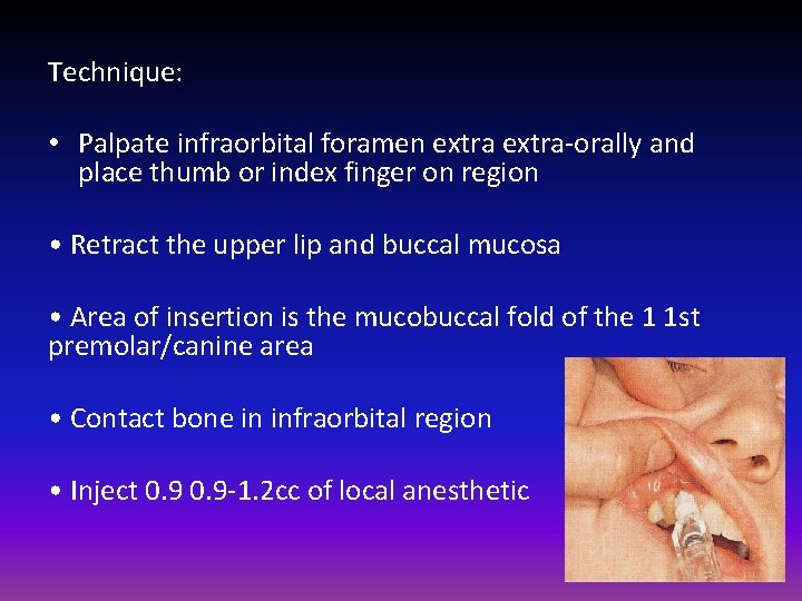 Technique: • Palpate infraorbital foramen extra-orally and place thumb or index finger on region