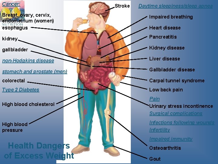 Cancer: Stroke Daytime sleepiness/sleep apnea Breast, ovary, cervix, endometrium (women) esophagus Impaired breathing kidney