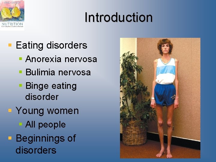 Introduction § Eating disorders § Anorexia nervosa § Bulimia nervosa § Binge eating disorder