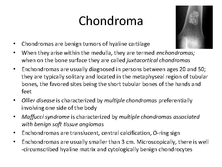 Chondroma • Chondromas are benign tumors of hyaline cartilage • When they arise within