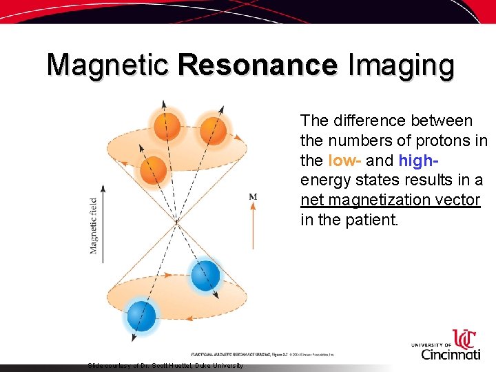 Magnetic Resonance Imaging The difference between the numbers of protons in the low- and