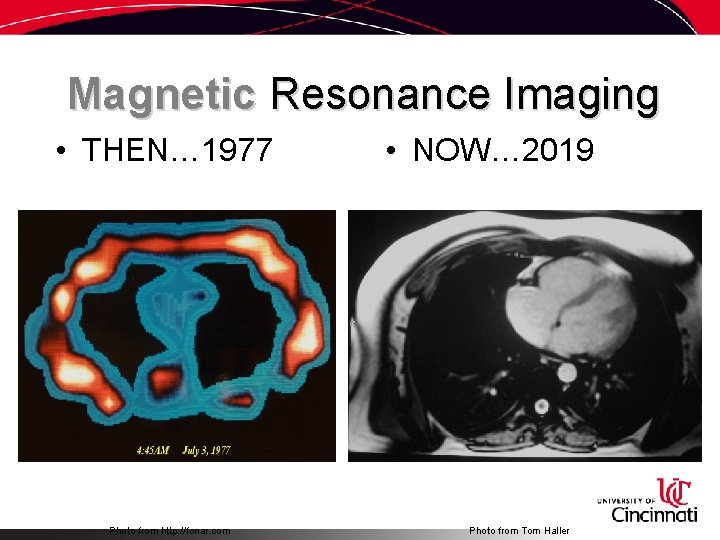 Magnetic Resonance Imaging • THEN… 1977 Photo from http: //fonar. com • NOW… 2019