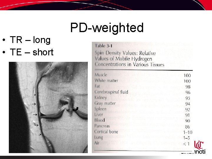  • TR – long • TE – short PD-weighted 