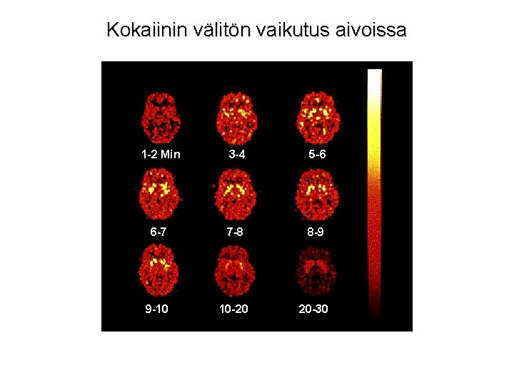 Kokaiinin välitön vaikutus aivoissa 1 -2 Min 3 -4 5 -6 6 -7 7