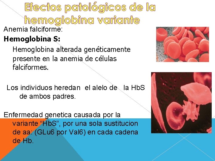 Anemia falciforme: Hemoglobina S: Hemoglobina alterada genéticamente presente en la anemia de células falciformes.