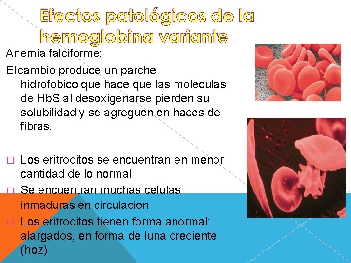 Anemia falciforme: El cambio produce un parche hidrofobico que hace que las moleculas de