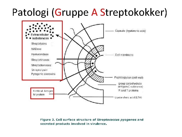 Patologi (Gruppe A Streptokokker) 