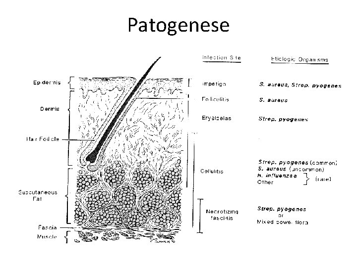 Patogenese 