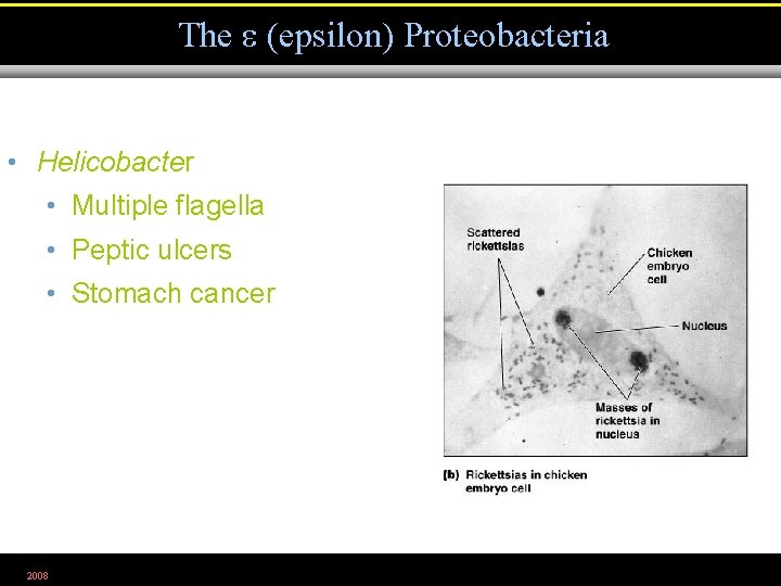 The (epsilon) Proteobacteria • Helicobacter • Multiple flagella • Peptic ulcers • Stomach cancer