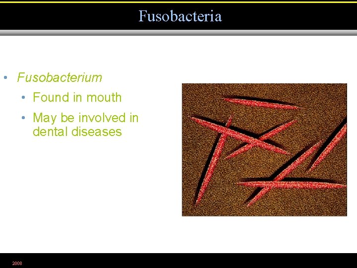 Fusobacteria • Fusobacterium • Found in mouth • May be involved in dental diseases
