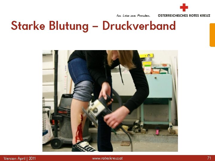 Starke Blutung – Druckverband Version April | 2011 www. roteskreuz. at 71 