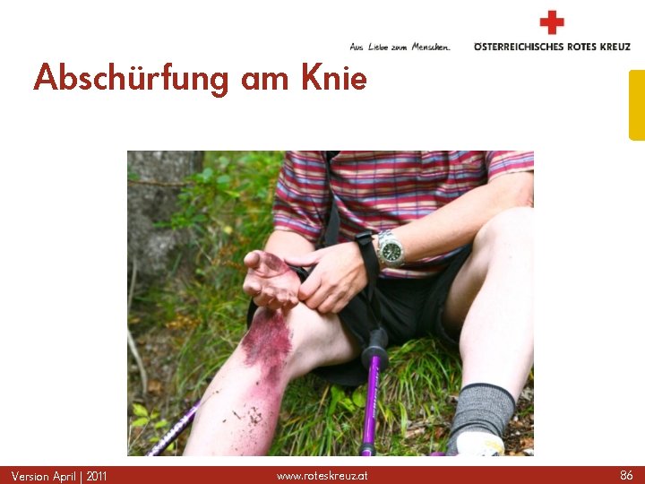 Abschürfung am Knie Version April | 2011 www. roteskreuz. at 86 