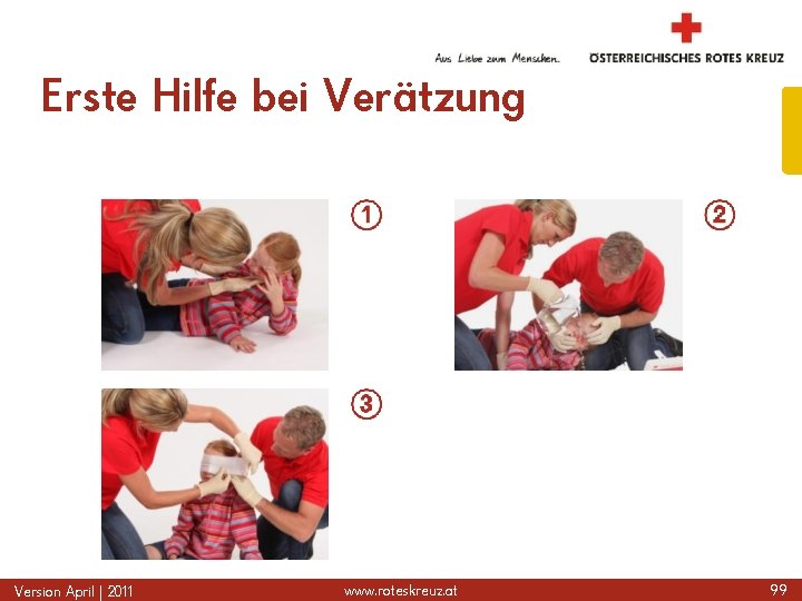Erste Hilfe bei Verätzung Version April | 2011 www. roteskreuz. at 99 