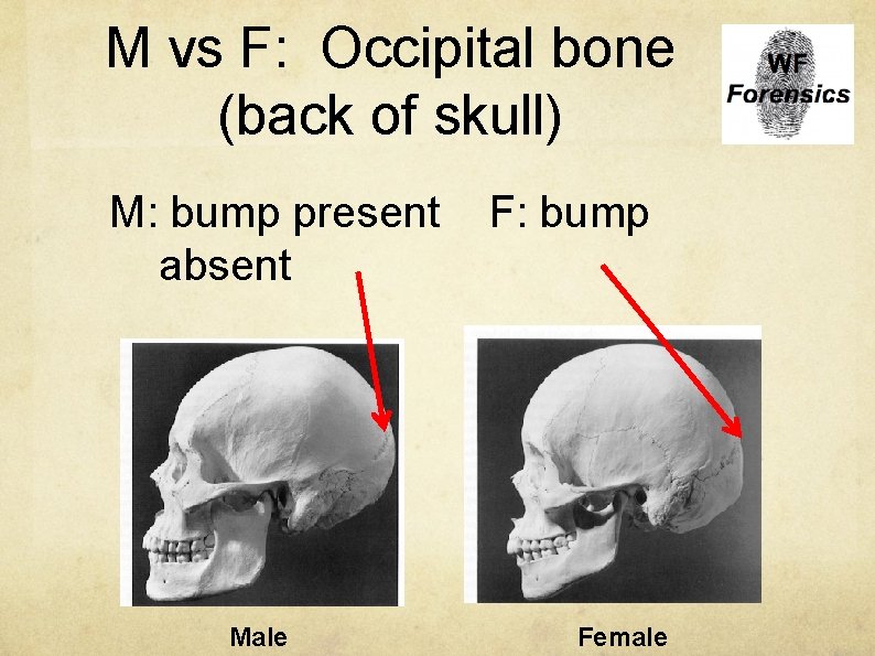 M vs F: Occipital bone (back of skull) M: bump present absent Male F: