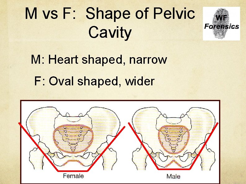 M vs F: Shape of Pelvic Cavity M: Heart shaped, narrow F: Oval shaped,