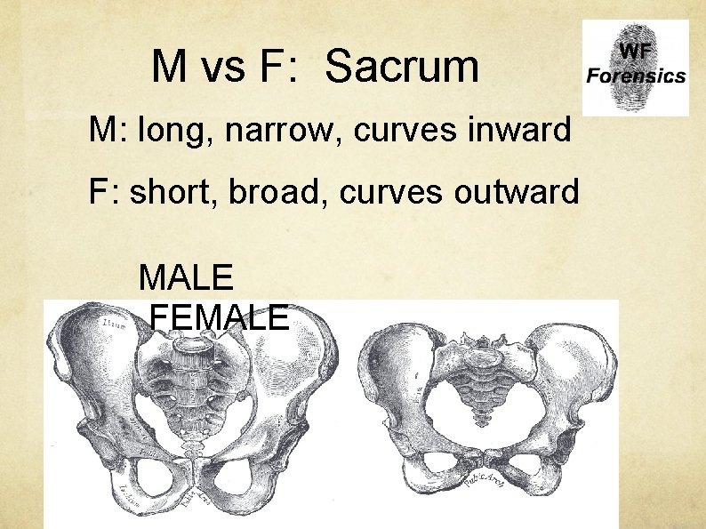 M vs F: Sacrum M: long, narrow, curves inward F: short, broad, curves outward