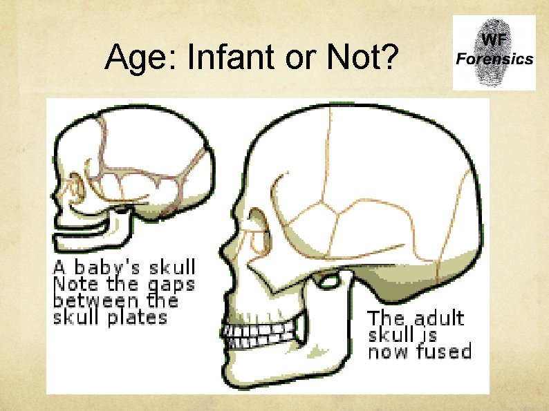 Age: Infant or Not? 