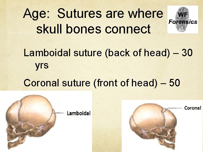 Age: Sutures are where skull bones connect Lamboidal suture (back of head) – 30