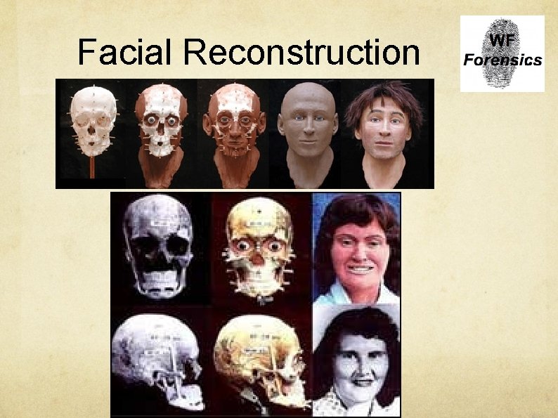 Facial Reconstruction 
