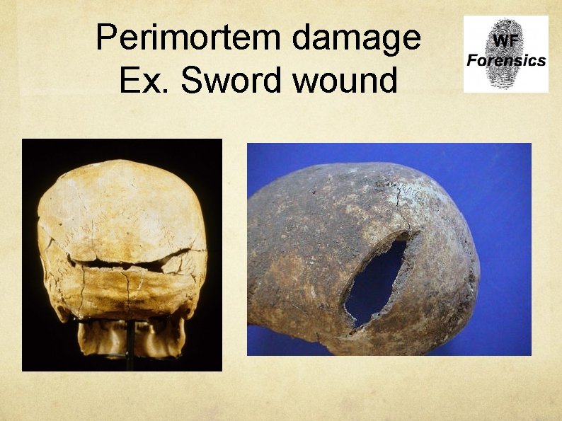 Perimortem damage Ex. Sword wound 
