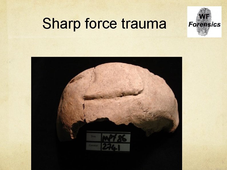 UNIT 3 FORENSIC ANTHROPOLOGY IMPRESSIONS Objective Identifying Male