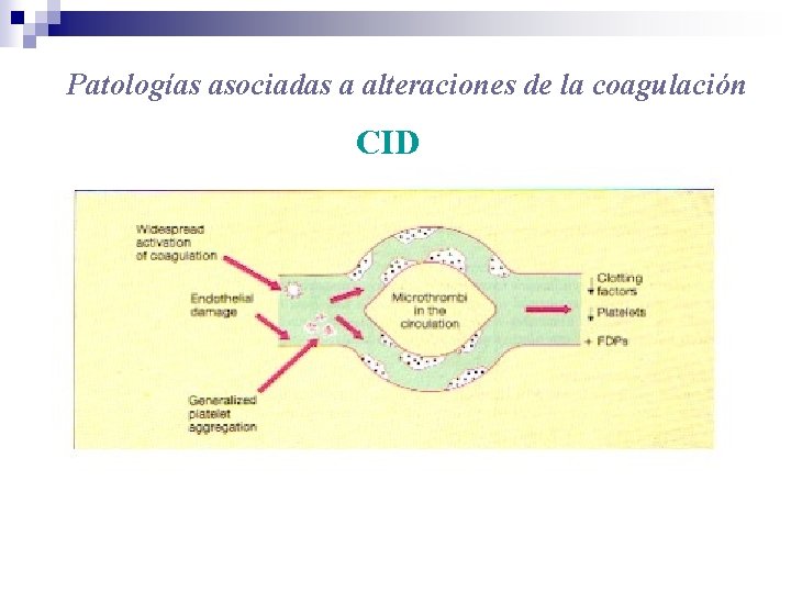 Patologías asociadas a alteraciones de la coagulación CID 