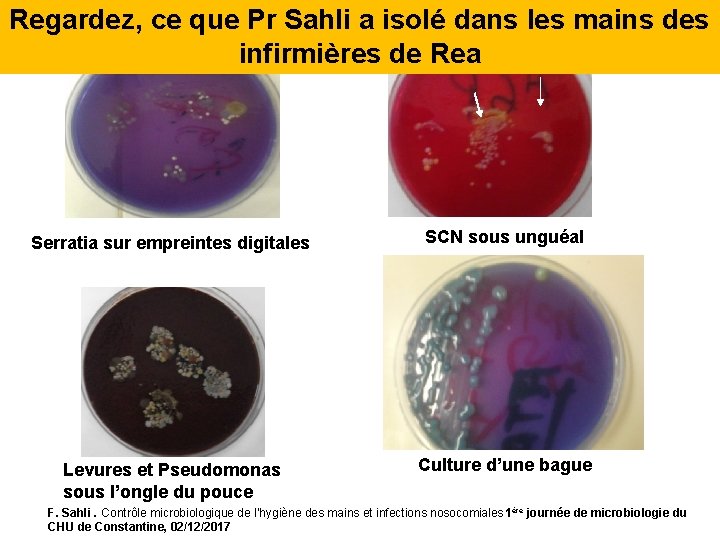 Regardez, ce que Pr Sahli a isolé dans les mains des infirmières de Rea