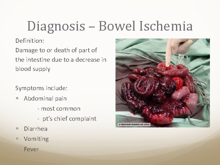 Diagnosis – Bowel Ischemia Definition: Damage to or death of part of the intestine
