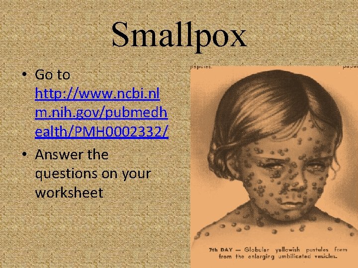 Smallpox • Go to http: //www. ncbi. nl m. nih. gov/pubmedh ealth/PMH 0002332/ •