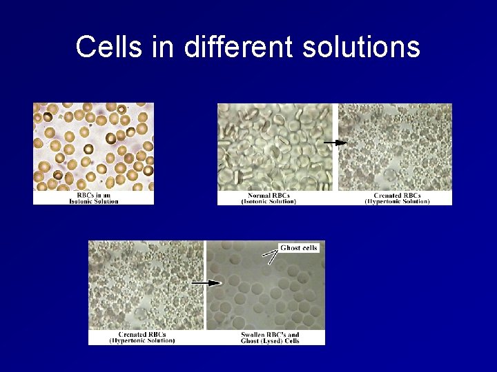 Cells in different solutions 