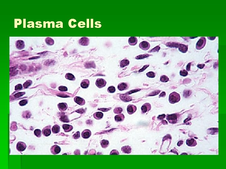 Plasma Cells 