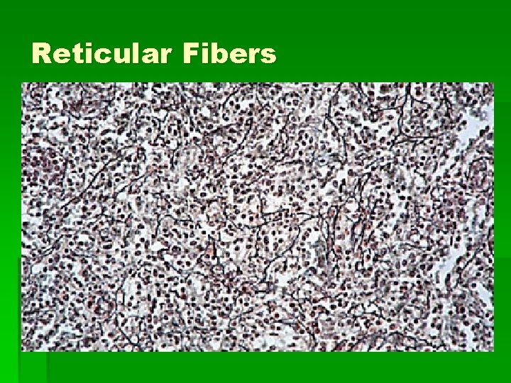 Reticular Fibers Reticular Fibers